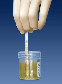 test-urines